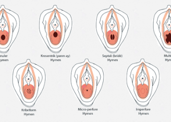 Kızlık Zarı Dikimi Çeşitleri Nelerdir?